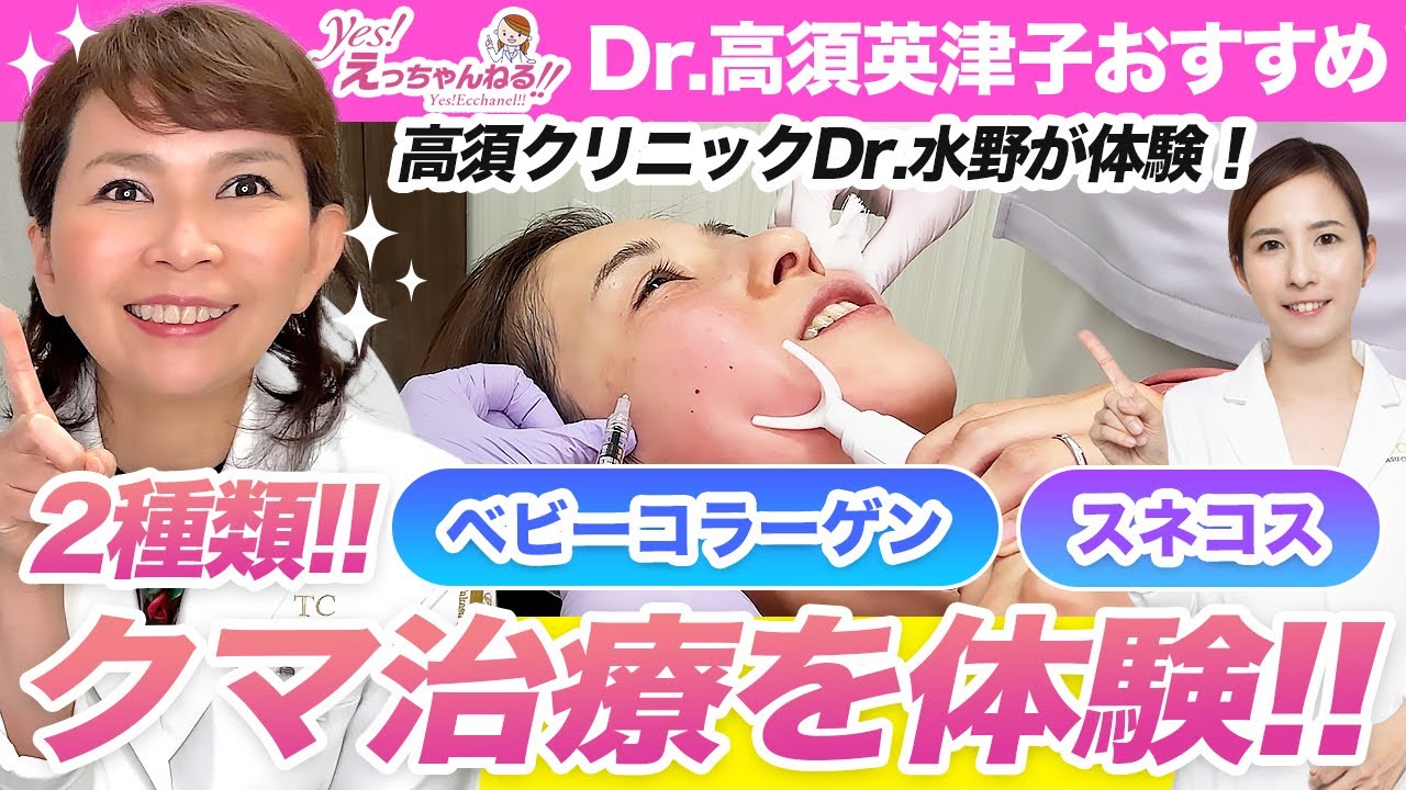 高須クリニックの水野先生に2種類の目のクマ治療を体験してもらいました！【ベビーコラーゲン】【スネコス】