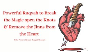 Powerful Ruqyah to Break the Magic open the knots & Remove the Jinns from the Heart 919062777292