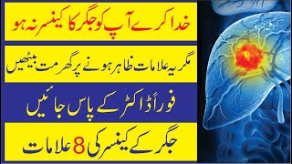Early Signs Of Liver Cancer Urdu/Hindi | Jigar Ke Cancer Ki Alamat | Stay Healthy