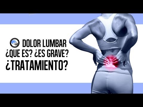 Video: Cómo determinar la causa del dolor lumbar (con imágenes)