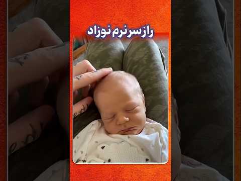 چرا به سر نوزاد نباید دست زد راز نرم ترین نقطه بدن نوزاد