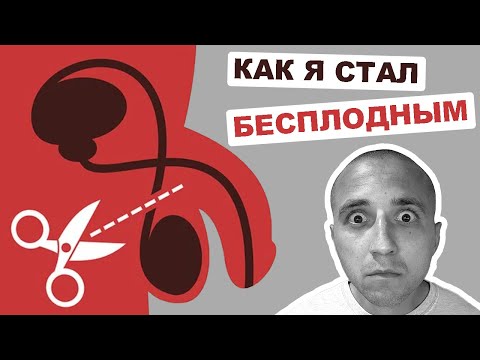 Видео: 3 способа забеременеть, если вашему партнеру сделали вазэктомию