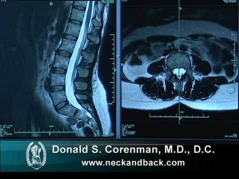 How to Read a MRI of the Normal Lumbar Spine | Lower-Back | Vail Spine Specialist