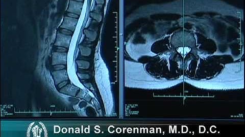How to Read a MRI of the Normal Lumbar Spine | Lower-Back | Vail Spine Specialist