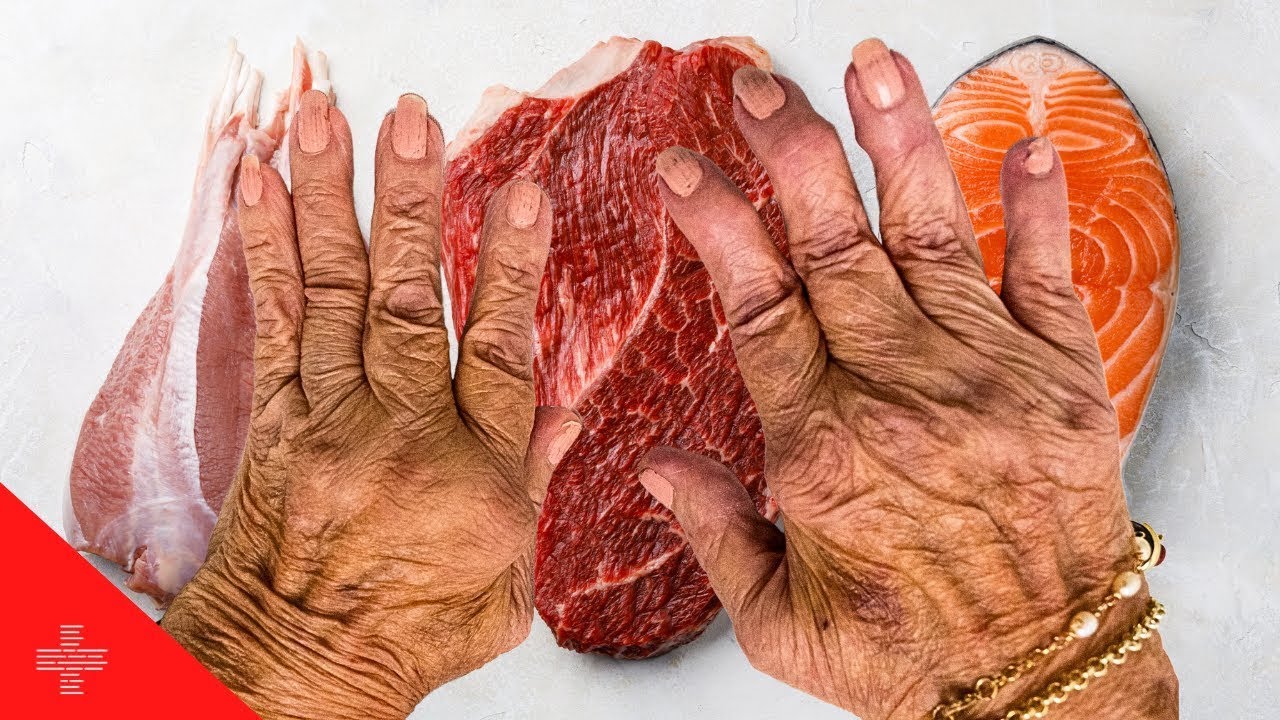 Foods to Avoid Over 50 If You Have Arthritis