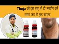 Best homeopathic treatment of warts          masse ka ilaj homeopathic