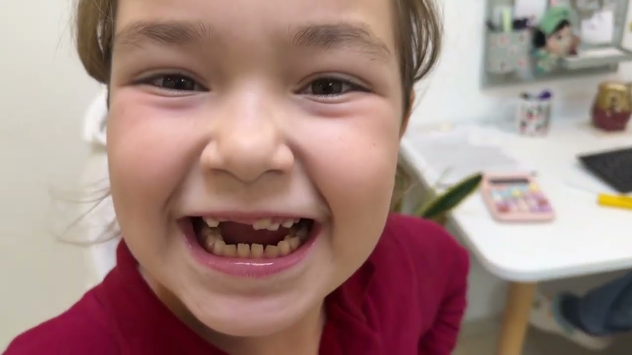 BUĞLEM EVİ TERKETTİ ‼️ MİNİK EVE TAŞINDI !! DOKTOR DİŞLERİNİ KONTROL ETTİ !!