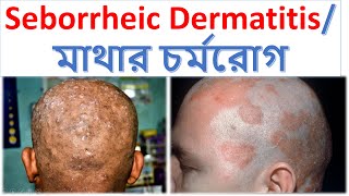 Skin Disease Or Fungal Infection Dr A Mannan