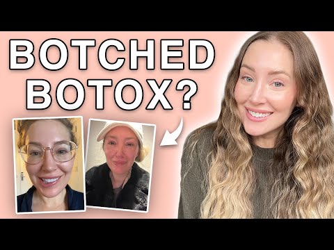 What REALLY Happens When Botox Goes Wrong?