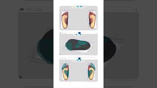How our new toe separators are made to measure!