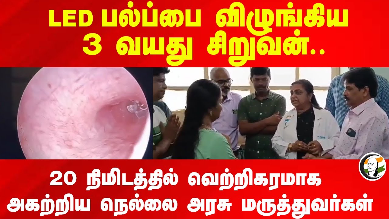 ⁣LED பல்ப்பை விழுங்கிய 3 வயது சிறுவன்.. 20 நிமிடத்தில் வெற்றிகரமாக அகற்றிய Nellai Govt Doctors