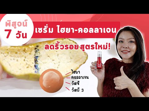 (เช็คสูตร) พิสูจน์ 7 วัน เซรั่ม ไฮยา-คอลลาเจน ดีกว่าจริงหรอ?? l พอนด์ส เอจ มิราเคิล เซรั่ม