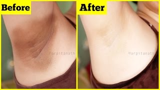 Whiten Dark Underarms Instantly | Remove Unwanted Body Hair | 100% Natural