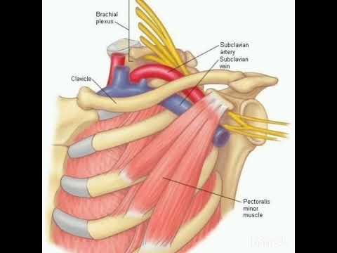 Малая грудная мышца - строение, функция. Синдром малой грудной мышцы