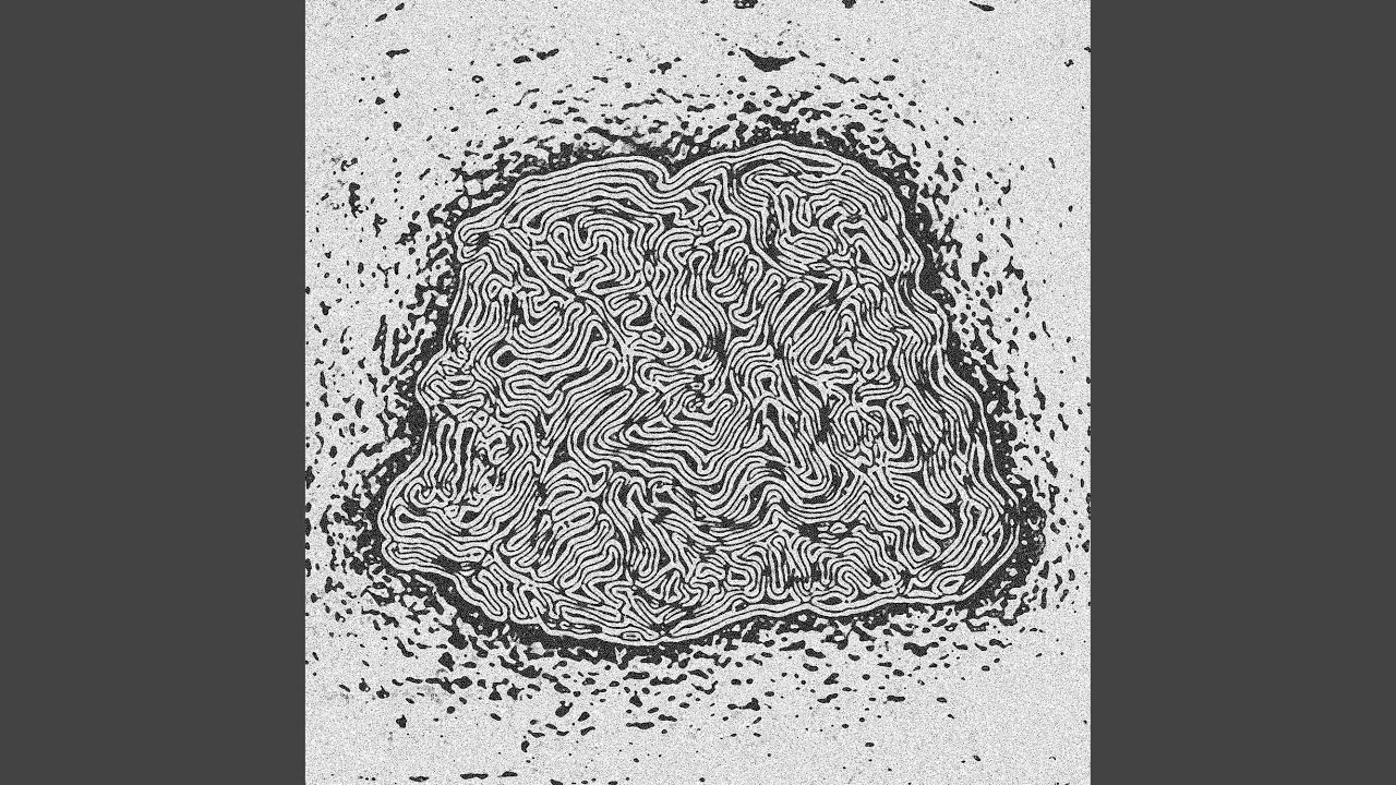 Missing Finger auf YouTube ansehen Missing Finger auf YouTube ansehen