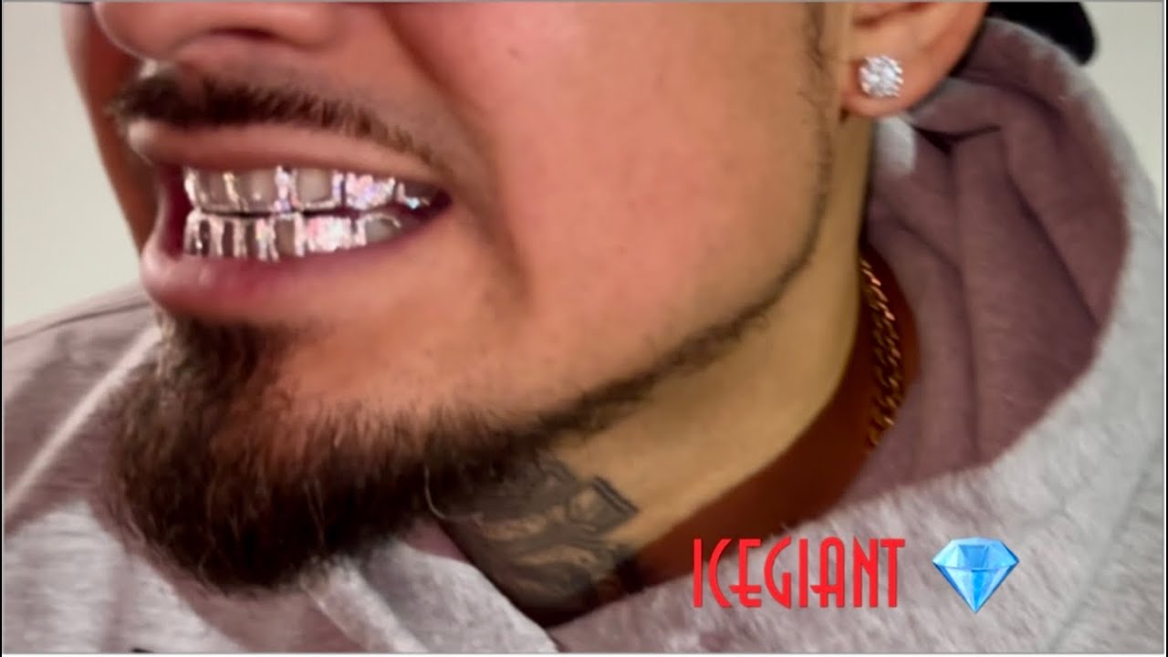 ICE GIANT open faced grillz!!!