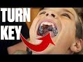 GETTING BRACES FOR THE FIRST TIME | EXPANDER WITH TURNING KEY | MAKING ROOM FOR MORE TEETH