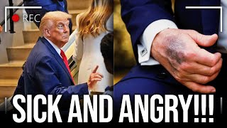 Trump Embarrasses Himself In Front Of EVERYONE