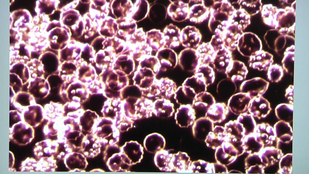 Live Blood Analysis Chart