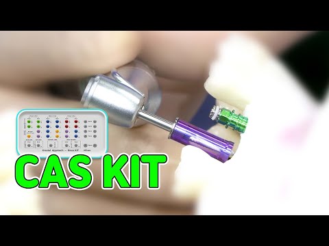 [EASY Hans-on] CAS KIT - #25, #26 Implant installation Case