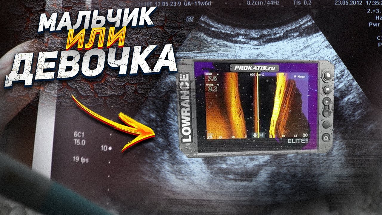 БОЖЕ, ЧТО ЭТО?!  Active target от LOWRANCE. ELITE FS7. Review Active Target [ПРОФЕССИОНАЛЬНЫЙ ОБЗОР]