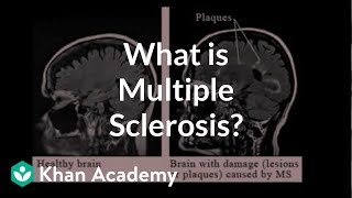 What is multiple sclerosis? | Nervous system diseases | NCLEX-RN | Khan Academy