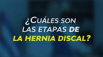 ¿Cuáles son las cuatro fases de la hernia discal?