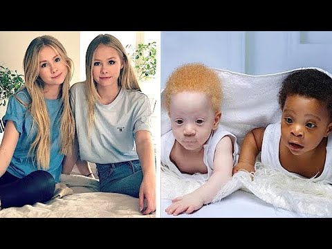 10 самых необычных близнецов, в существование которых вы не поверите!
