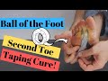 2nd Toe Pain Capsulitis & Ball of Foot Taping [2021 Home Treatment]