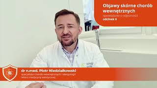 Objawy skórne chorób wewnętrznych - odcinek 6