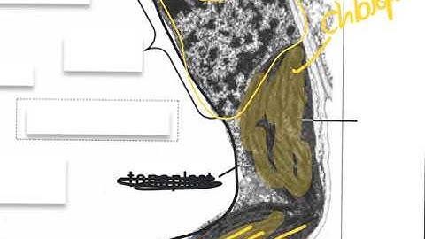 Unit 1. 1 - Lesson 1 and 2 - Electron Micrographs - Activity 6