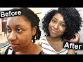 I GOT MY FACE MOLES REMOVED IN KOREA (BEFORE & AFTER) |Black Girl in Korea Vlog