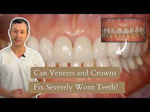 Smile Makeover