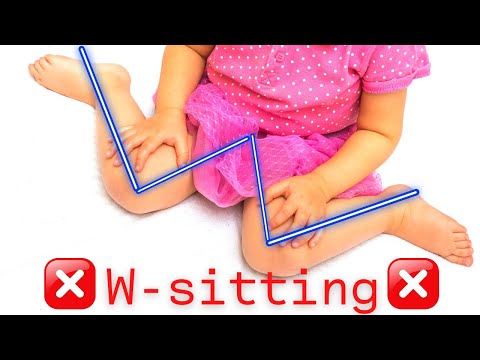 DON'T LET YOUR BABY SIT LIKE THAT! W-SITTING DANGERS ⛔
