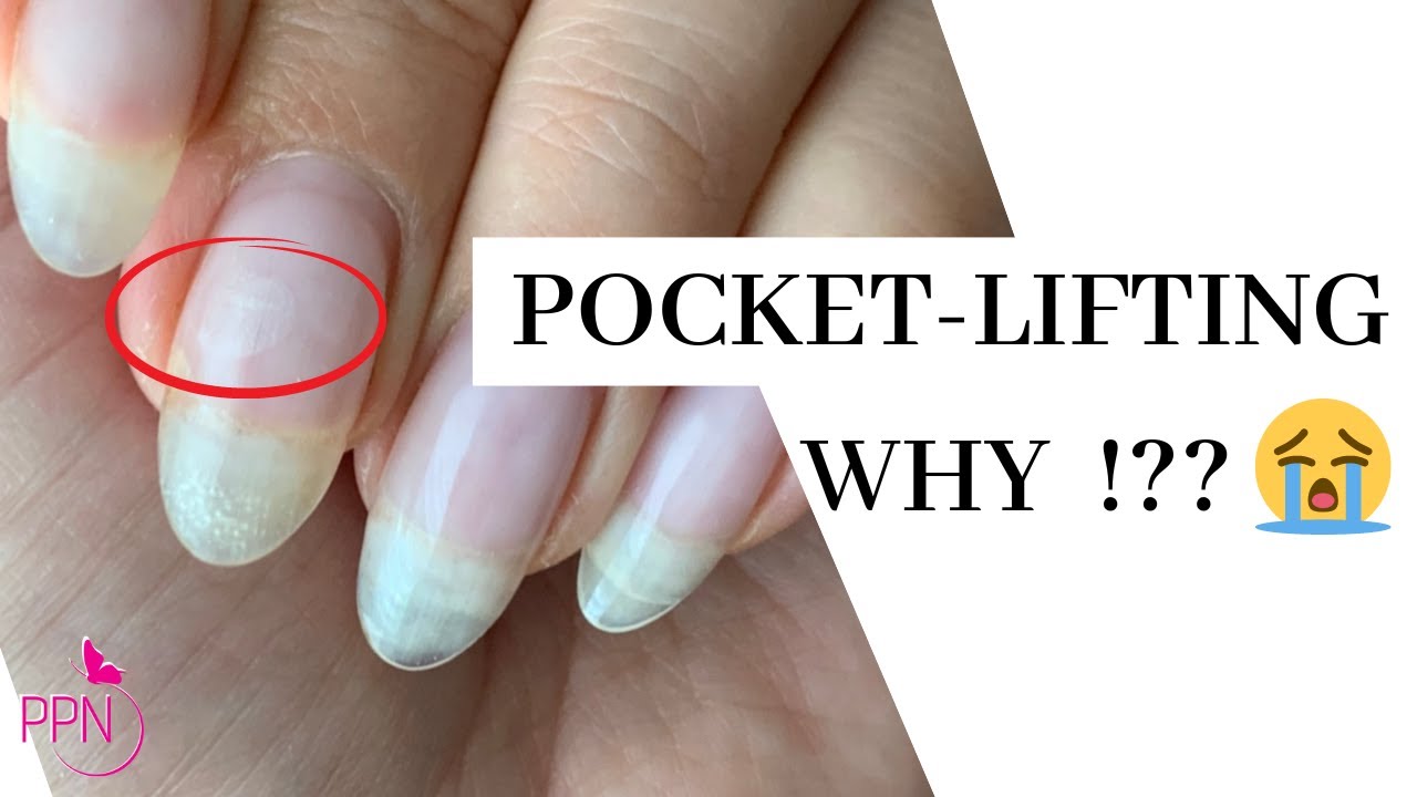 What Causes Pocket Lifting In Gel Nails And How To Prevent It