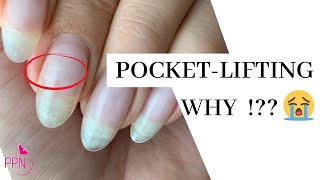 What Causes Pocket Lifting In Gel Nails And How To Prevent It screenshot 5