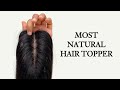 Most Realistic Hair Toppers For Hair Thinning | Hair Toppers For Beginners | Hair Toppers #Shorts