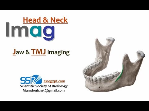Mastering Mandibular Anatomy on CBCT: A Radiologist's Guide ...
