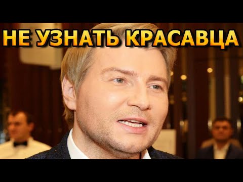 ТЫ НЕ ПОВЕРИШЬ! Как выглядел Николай Басков до пластической операции...