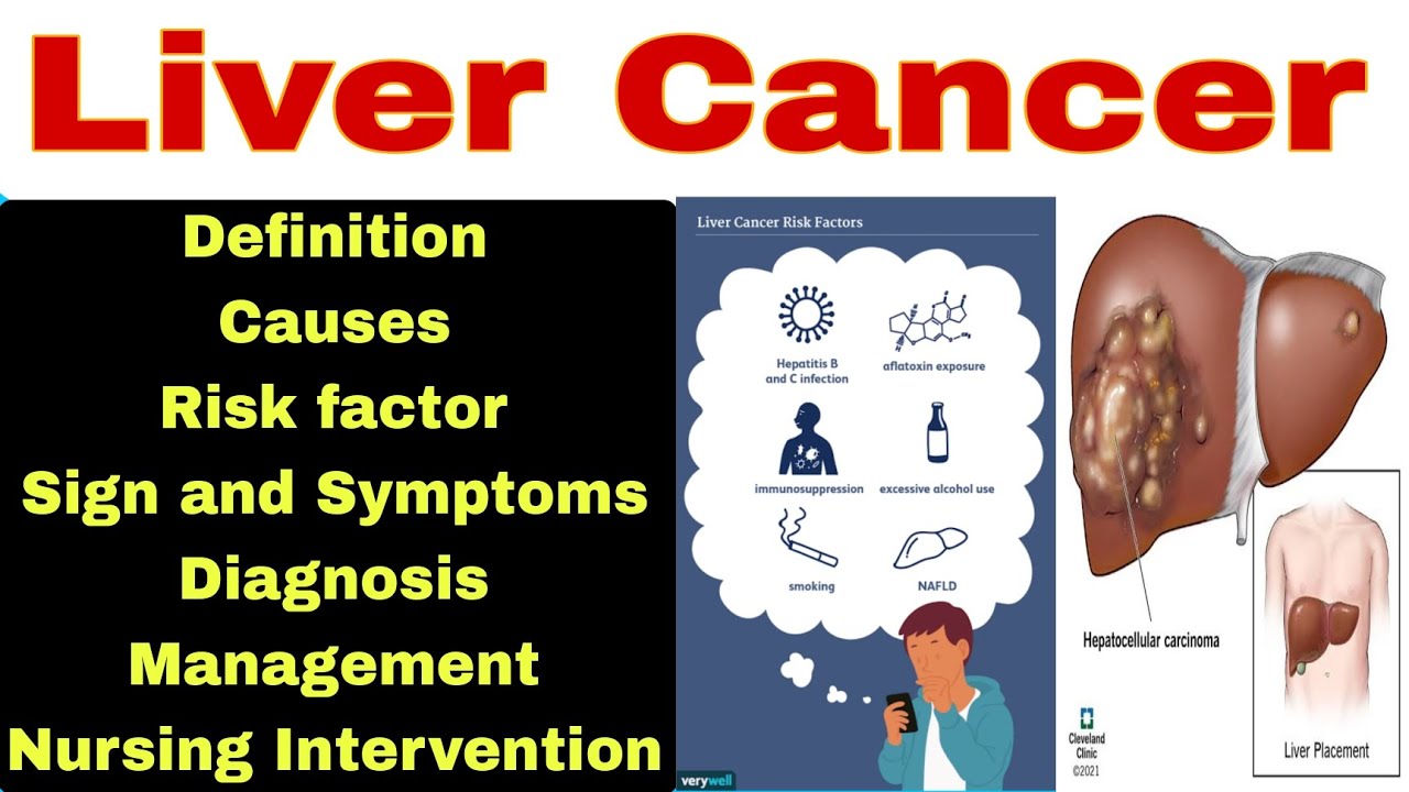 Liver Cancer YouTube