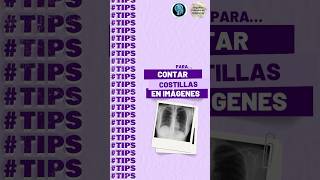 TIPS para contar costillas en radiográfias