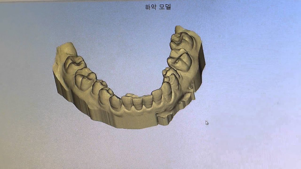 [一日牙科診所] ONEDAY DENTISTRY — 透過3D列印機製作隱形矯正器的數位化流程