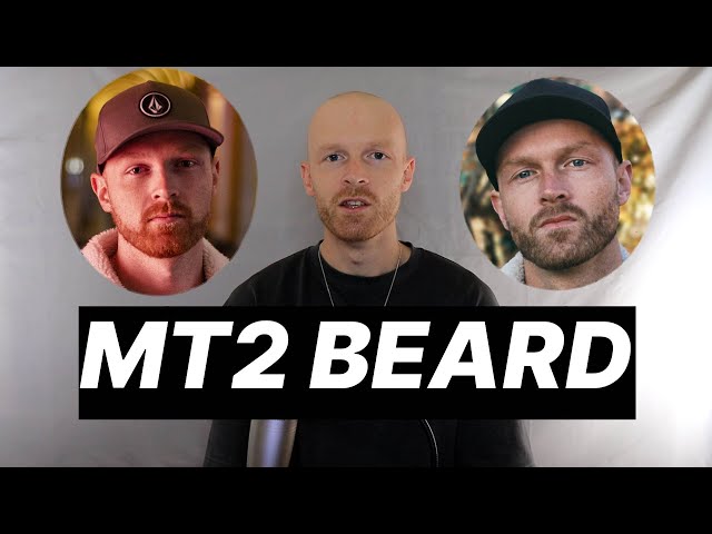 melanotan ginger Melanotan Turned My Beard Black