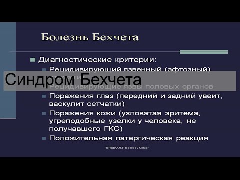 Синдром Бехчета