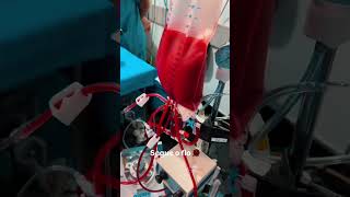 Cardiac Surgery In Operating Room...