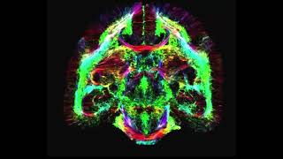 Tractography from DWI