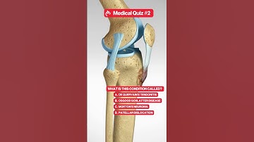 Can You Name This Medical Condition?