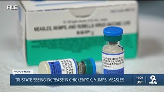 Cincinnati area seeing increase in chickenpox, mumps, measles Shannon Westerlund Measles Mumps And Chicken Pox Can Be Life Threatening