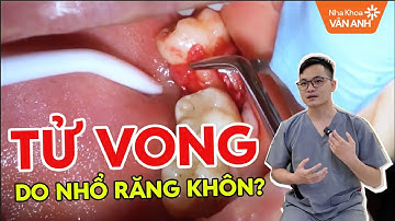 Tử Vong Sau Khi Nhổ Răng Khôn – Bác Sĩ Cảnh Báo 3 Nguyên Nhân Cực Nguy Hiểm!