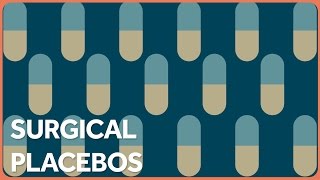 The Shocking Truth About Surgical Placebos